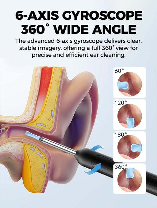 Electric Ear Wax Removal Tool