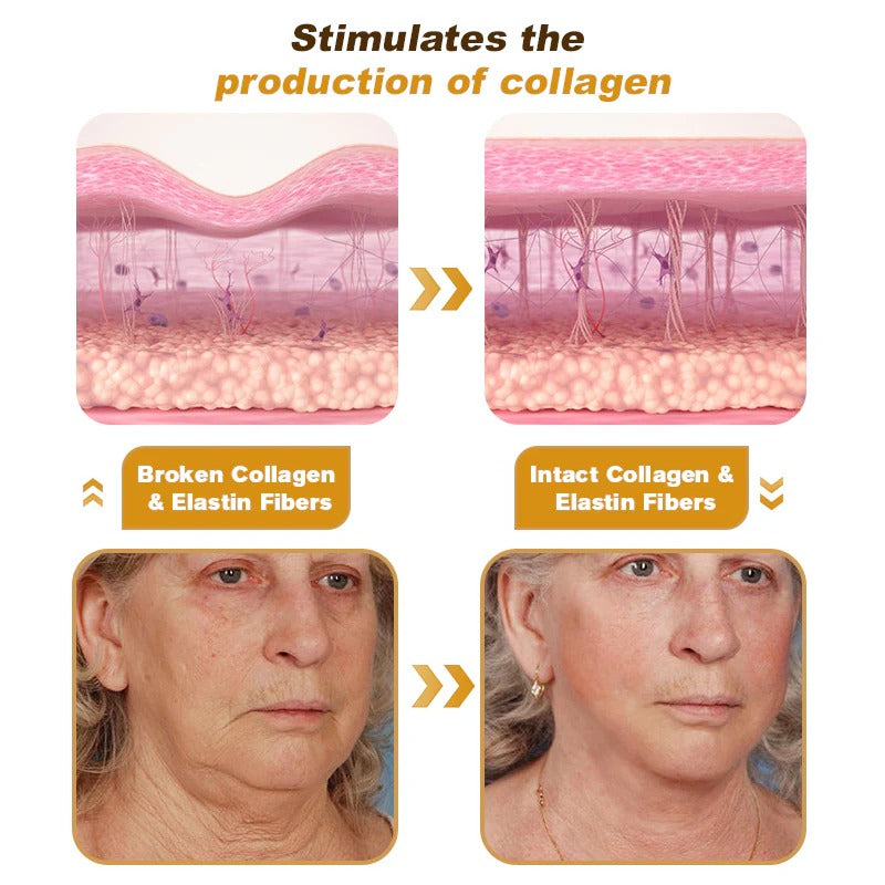 Botox Bee Venom Wrinkle Removal Cream