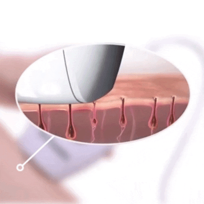 Original IPL Laser Hair Removal Device Kit